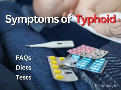 symptom of typhoid fever, faqs of typhoid fever and symptoms, pro lifestyle, prolifestyle, typhoid fever symptoms and its symptoms