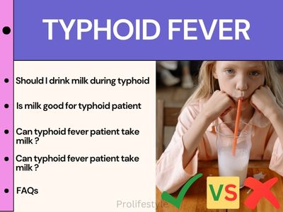 Should I drink milk during typhoid & FAQs