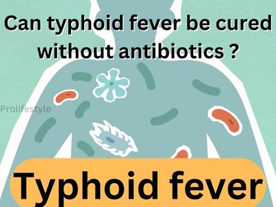 Can typhoid fever be cured without antibiotic