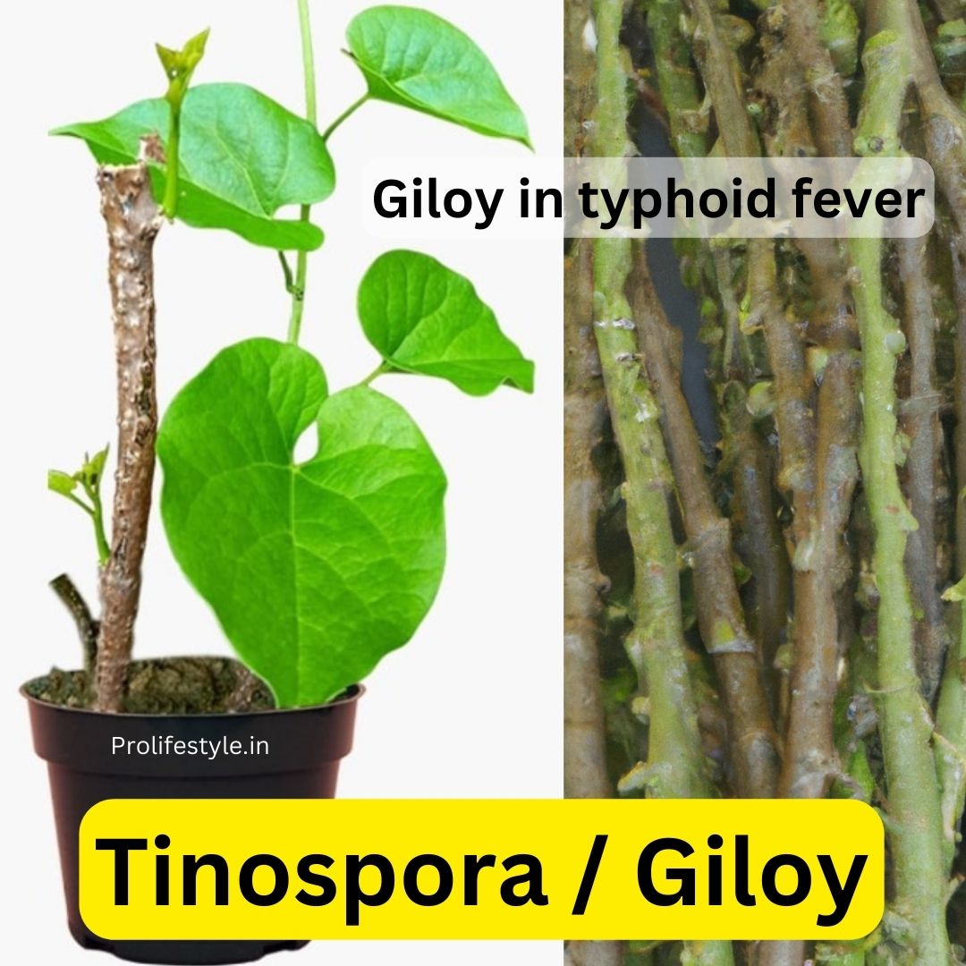 Giloy in typhoid fever