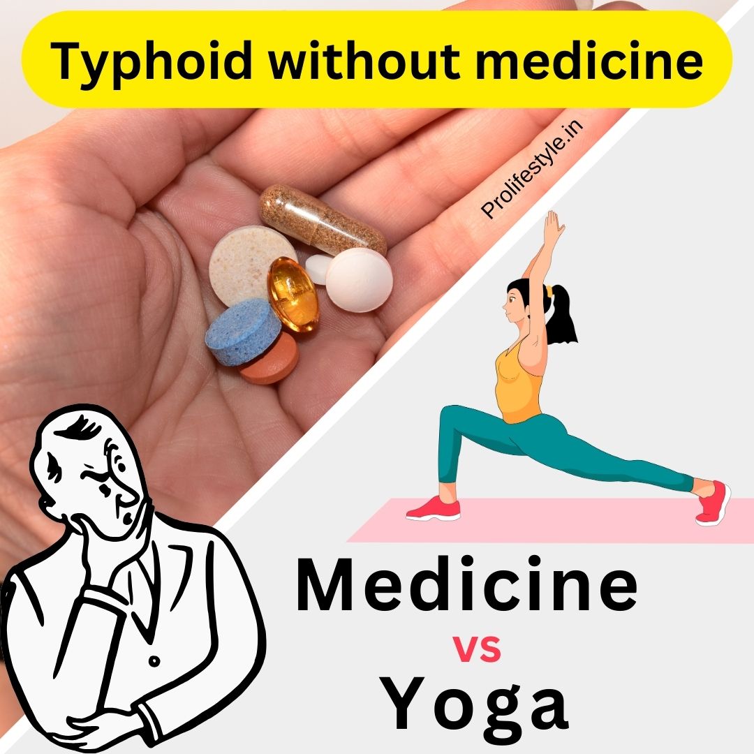 Can we cure typhoid without medicine