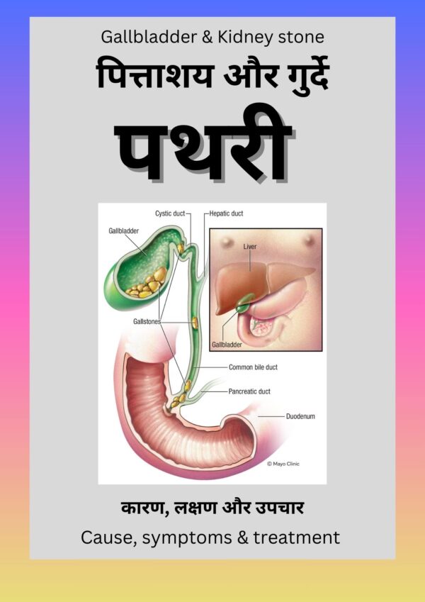 पित्ताशय,गुर्दे की पथरी ( PDF ) - Image 3